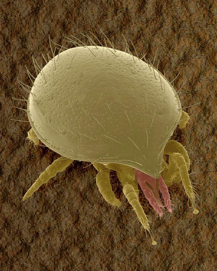 Tortoise Mite (family Uropodidae) Photograph by Dennis Kunkel