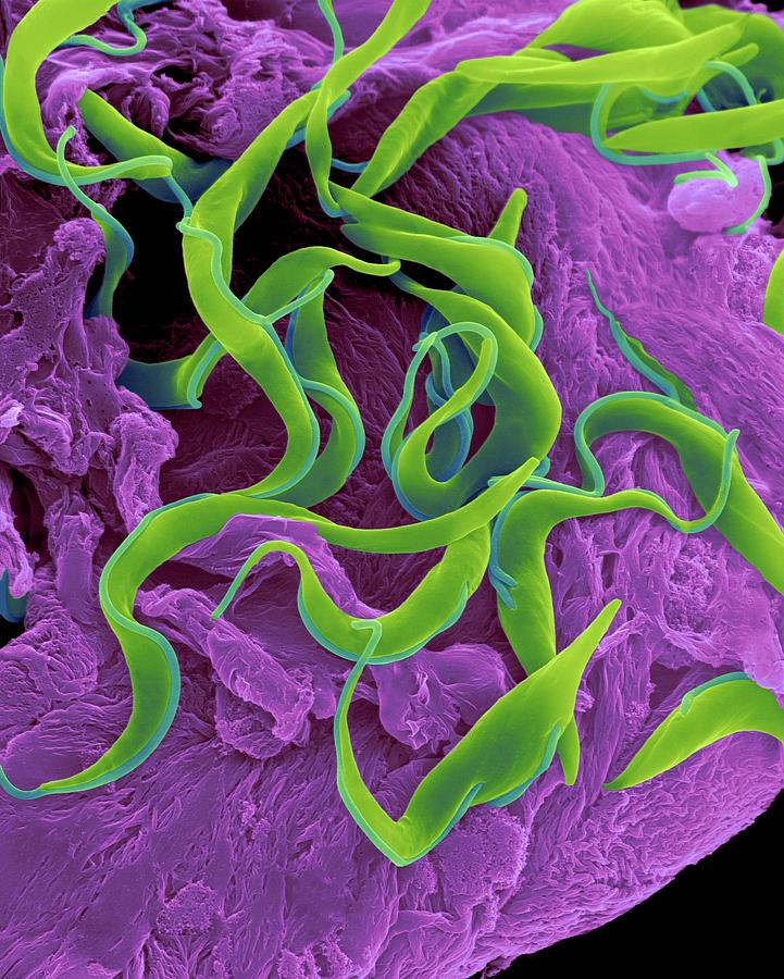 Trypanosome Trypomastigote Protozoan #3 Photograph by Dennis Kunkel Microscopy/science Photo Library