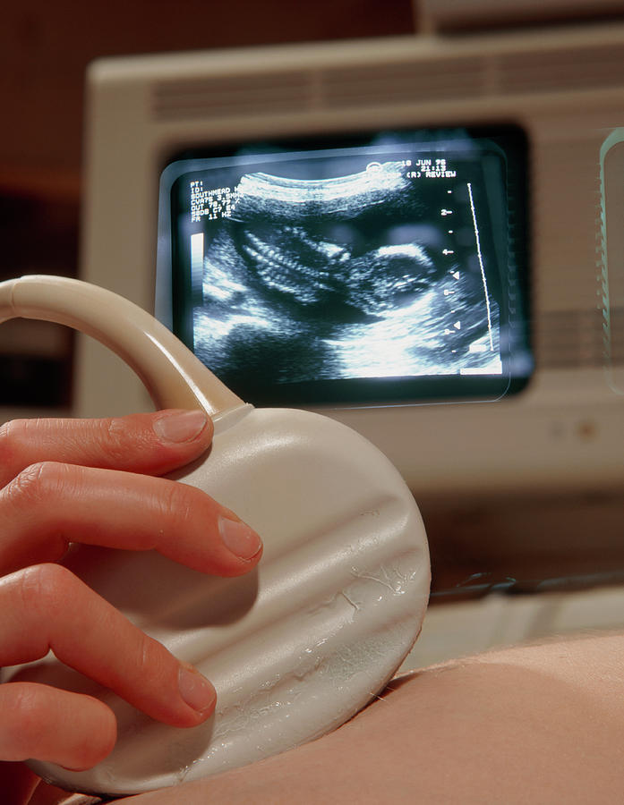 Ultrasound Photograph - Ultrasound Scanning Of A Pregnant Woman #3 by Saturn Stills/science Photo Library