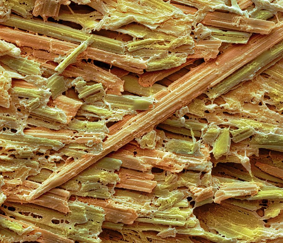 Uric Acid Crystals #3 Photograph by Steve Gschmeissner
