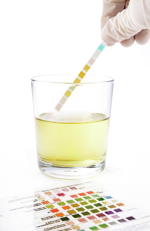 Urine Home Test Kit Photograph By Cordelia Molloy Pixels