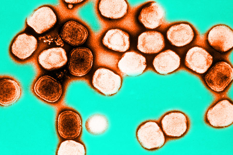 Vaccinia Virus, Eradicated Smallpox, Tem #3 Photograph by Science Source