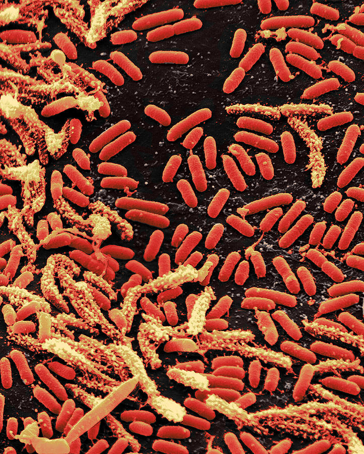 Vibrio Bacteria, Sem #3 Photograph by Science Source