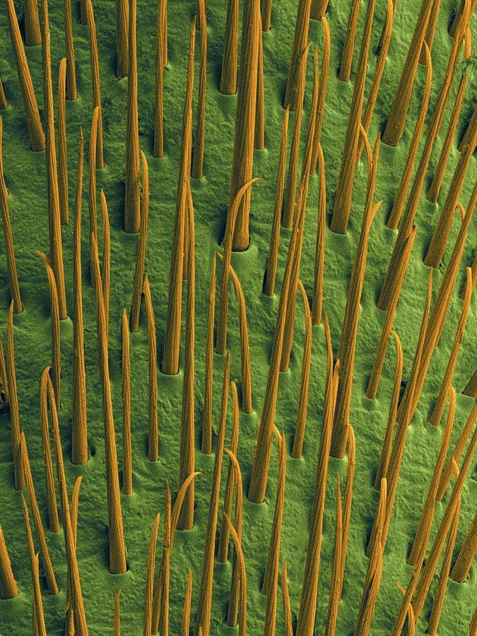 Water Strider Leg #3 Photograph by Dennis Kunkel Microscopy/science Photo Library
