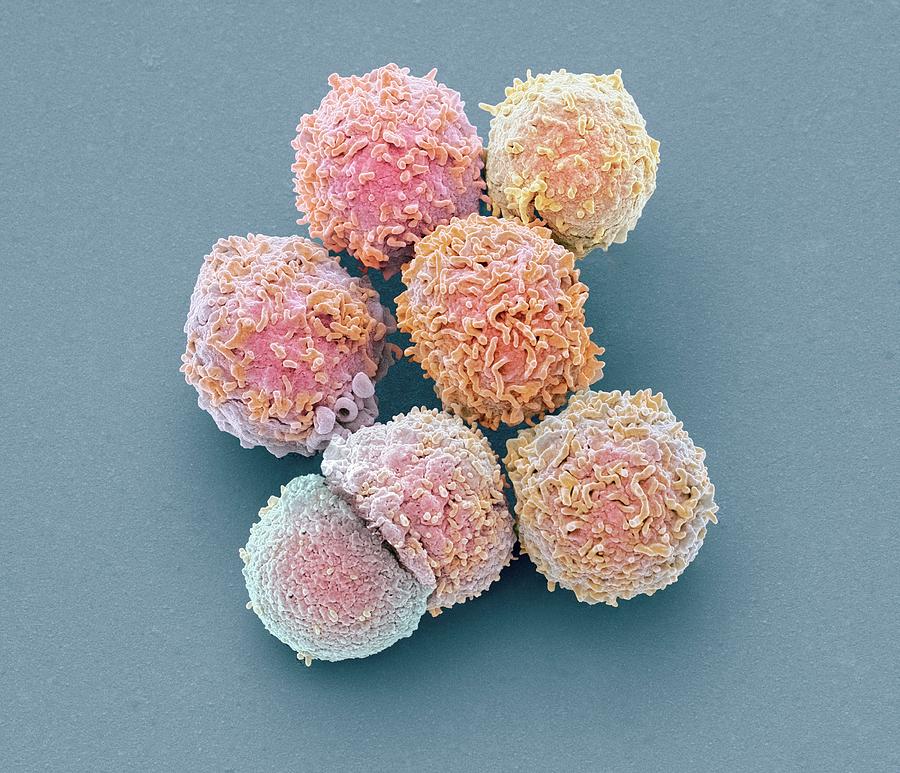 White Blood Cells Photograph by Steve Gschmeissner