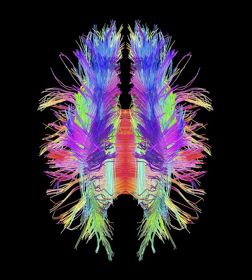 White matter fibres and brain, artwork #3 Photograph by Science Photo Library
