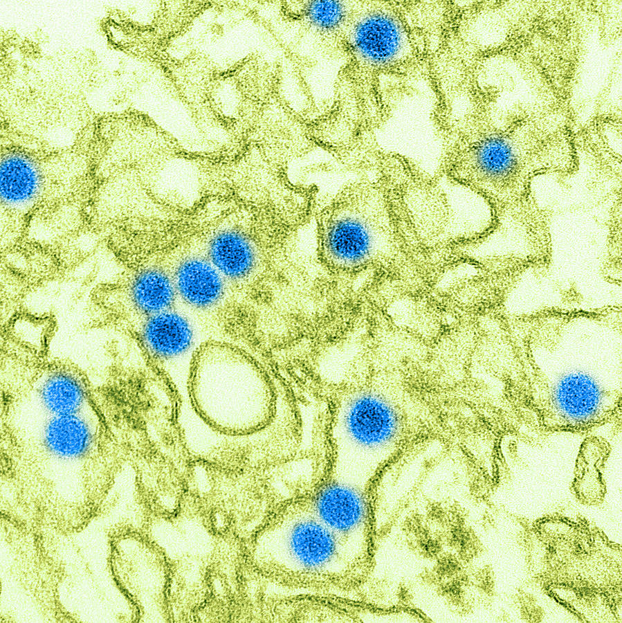 Zika Virus, Tem #3 Photograph by Science Source