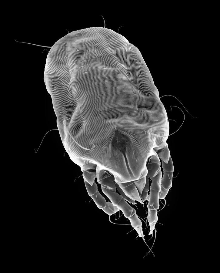 Dust Mite #30 Photograph by Dennis Kunkel Microscopy/science Photo Library