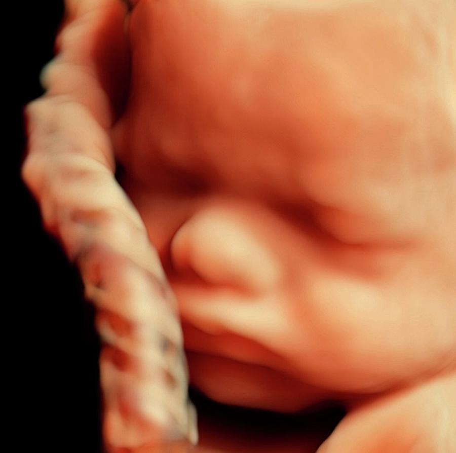 32 Week Foetus Photograph by Bernard Benoit