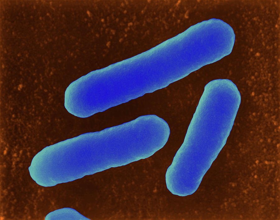 E Coli Photograph By Dennis Kunkel Microscopyscience Photo Library Pixels 7217