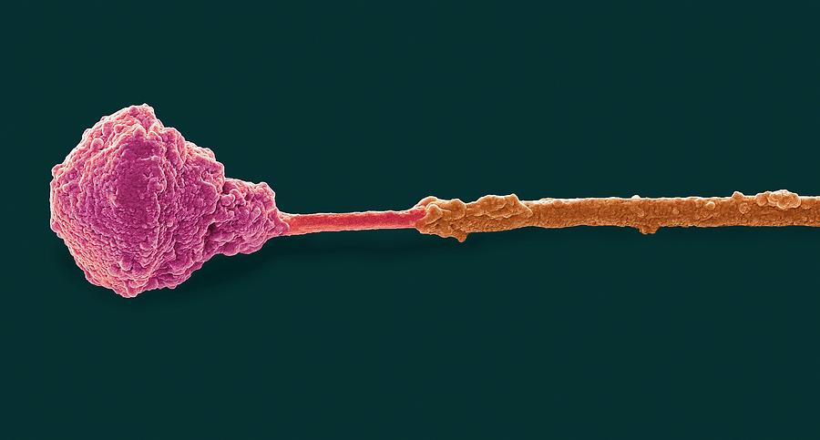 Abnormal Human Sperm Cell #4 Photograph by Steve Gschmeissner