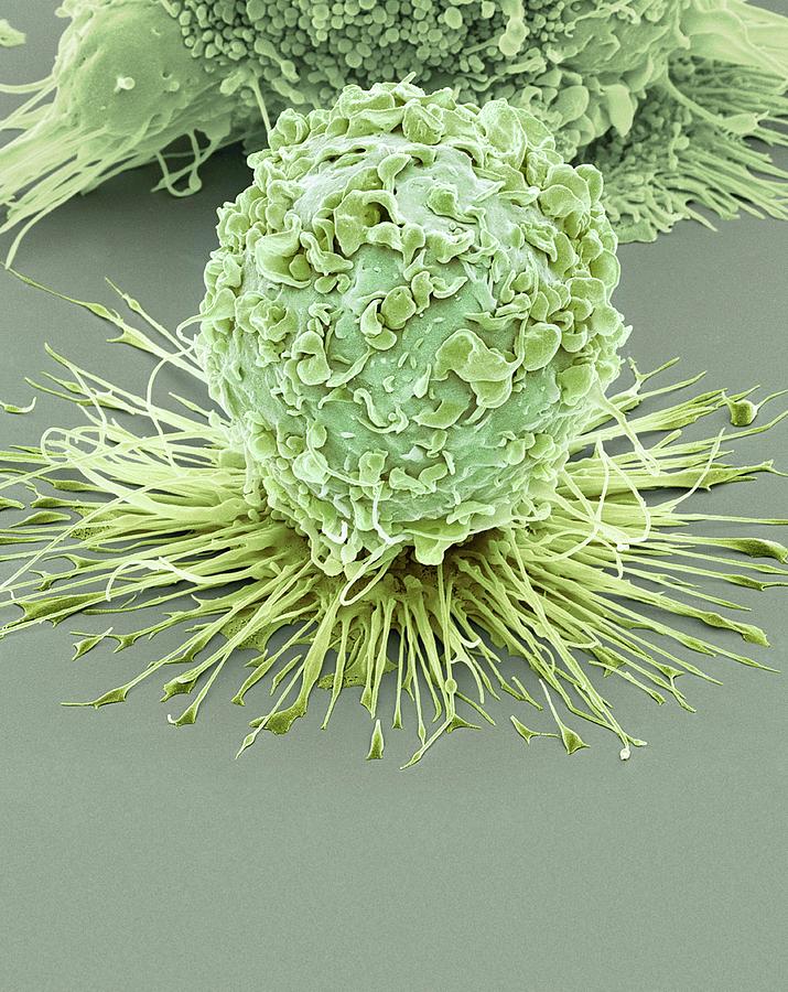 Activated Macrophage #4 Photograph by Steve Gschmeissner