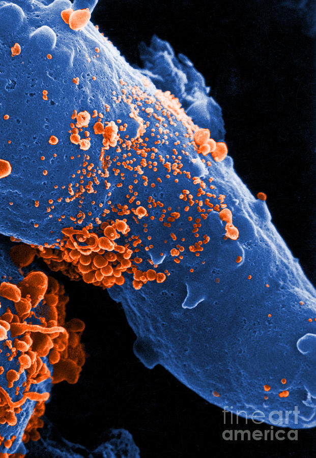 Aids Virus #4 Photograph by Dr. Cecil H. Fox
