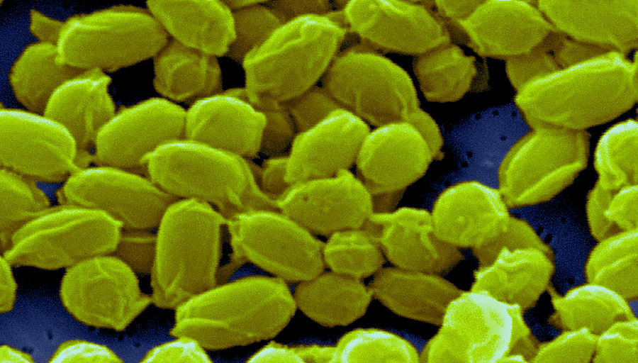 Anthrax, Bacillus Anthracis Bacteria #4 Photograph by Science Source