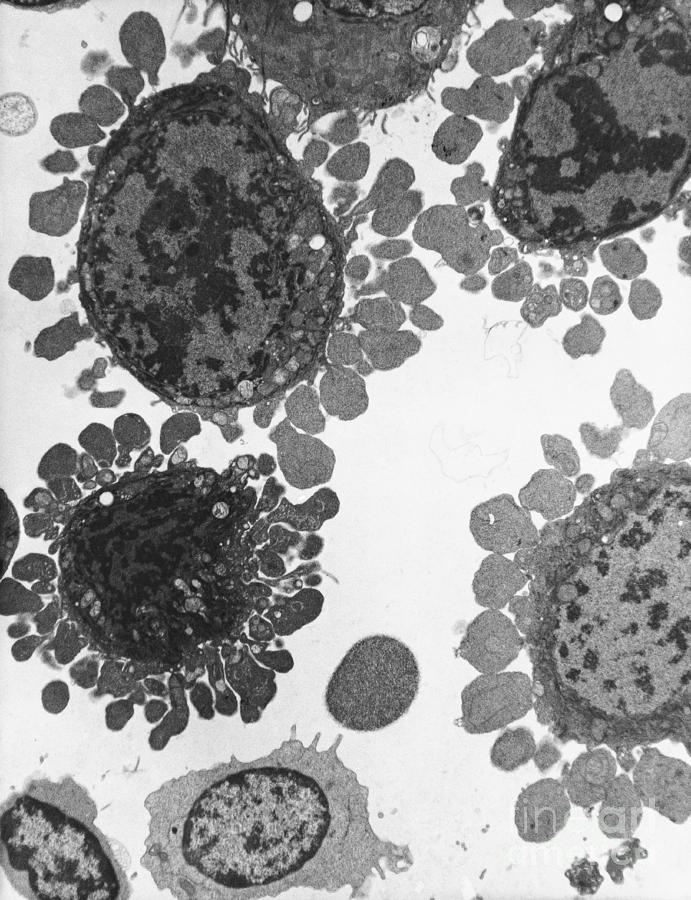 Apoptosis Human Lymphocyte Tem Photograph By David M Phillips