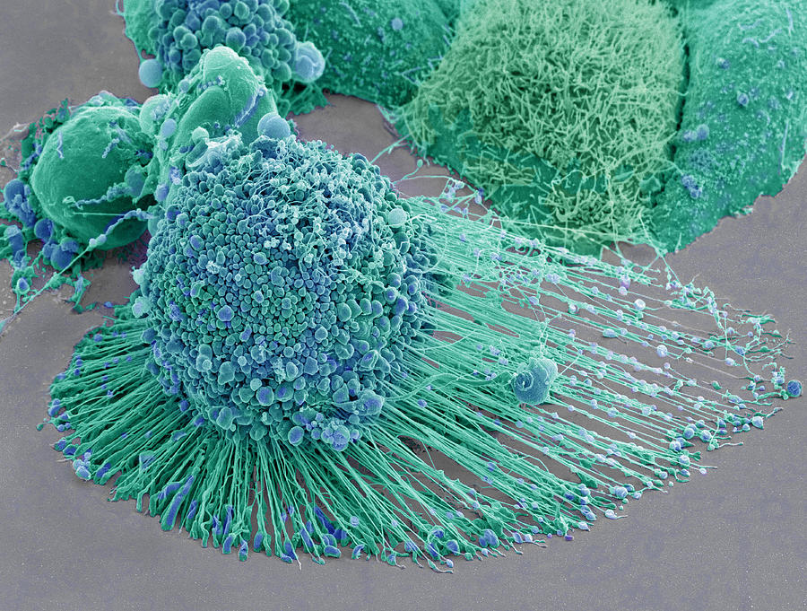 Apoptotic Hela Cell, Sem #4 Photograph by Science Source