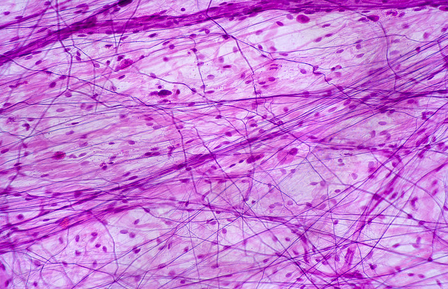 Areolar Connective Tissue Histology