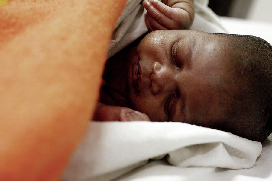 Baby With Atresia #4 Photograph by Science Photo Library Baby With Atresia #4 Photograph by Science Photo Library