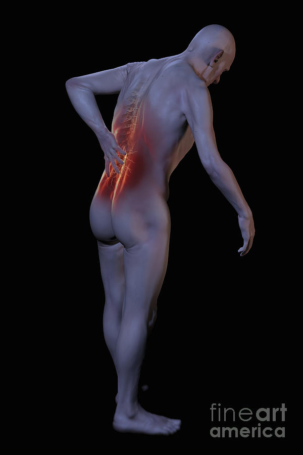 Back Pain #4 Photograph by Science Picture Co