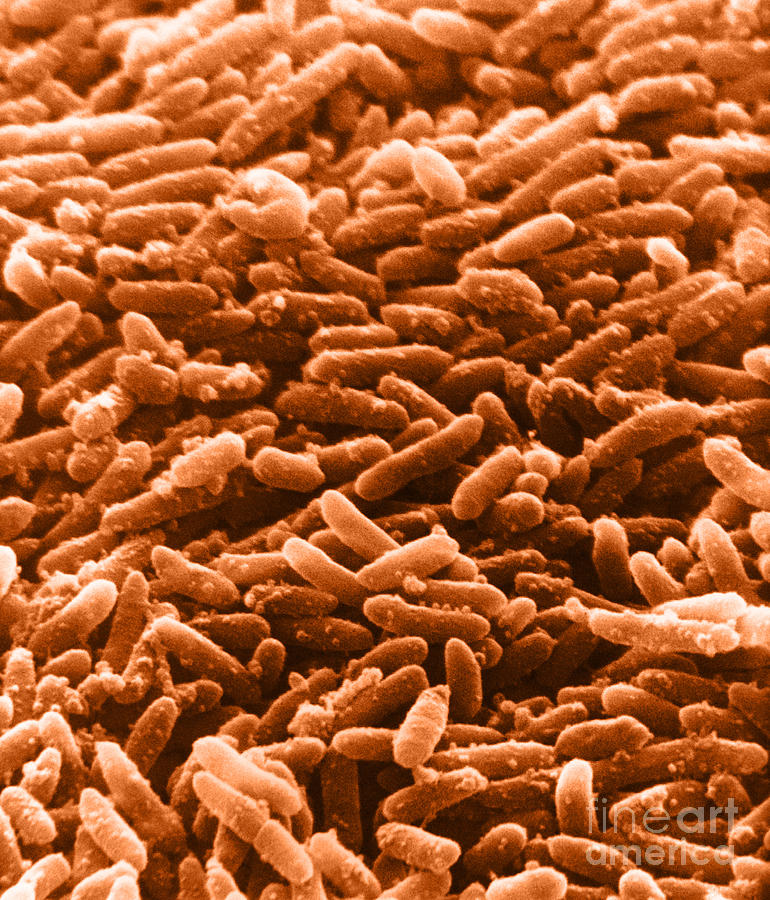 Bacterial Photograph - Bacteria, Sem #4 by David M. Phillips