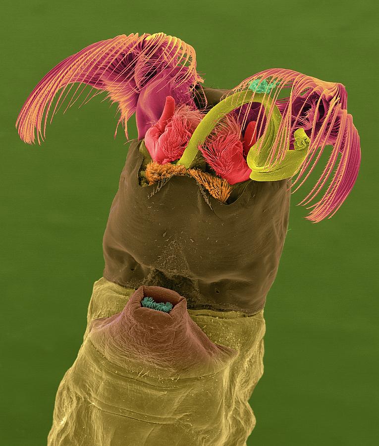 Black Fly Larva Photograph by Dennis Kunkel Microscopy/science Photo ...