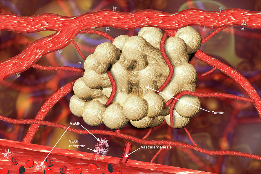 Blood Vessel Formation #4 Photograph by Carol & Mike Werner/science Photo Library