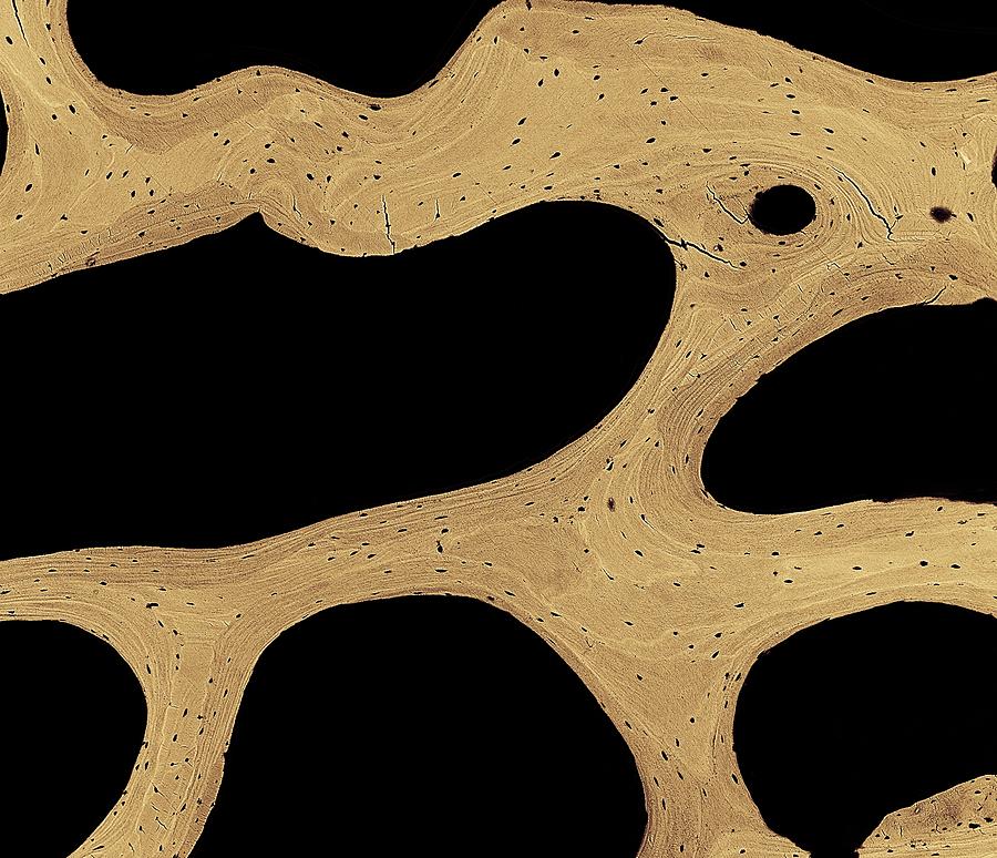 Bone Cross-section Photograph by Science Photo Library