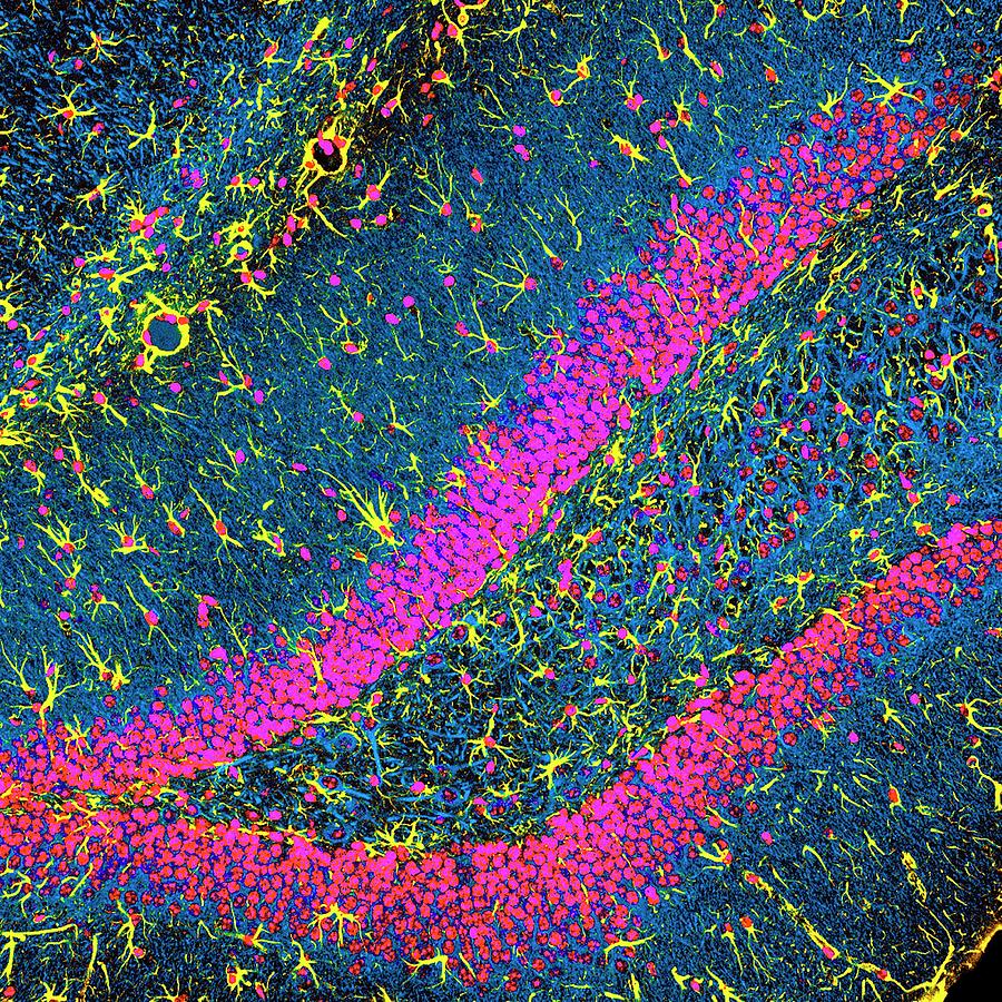 Anatomical Photograph - Brain Cells #4 by Dr. Chris Henstridge
