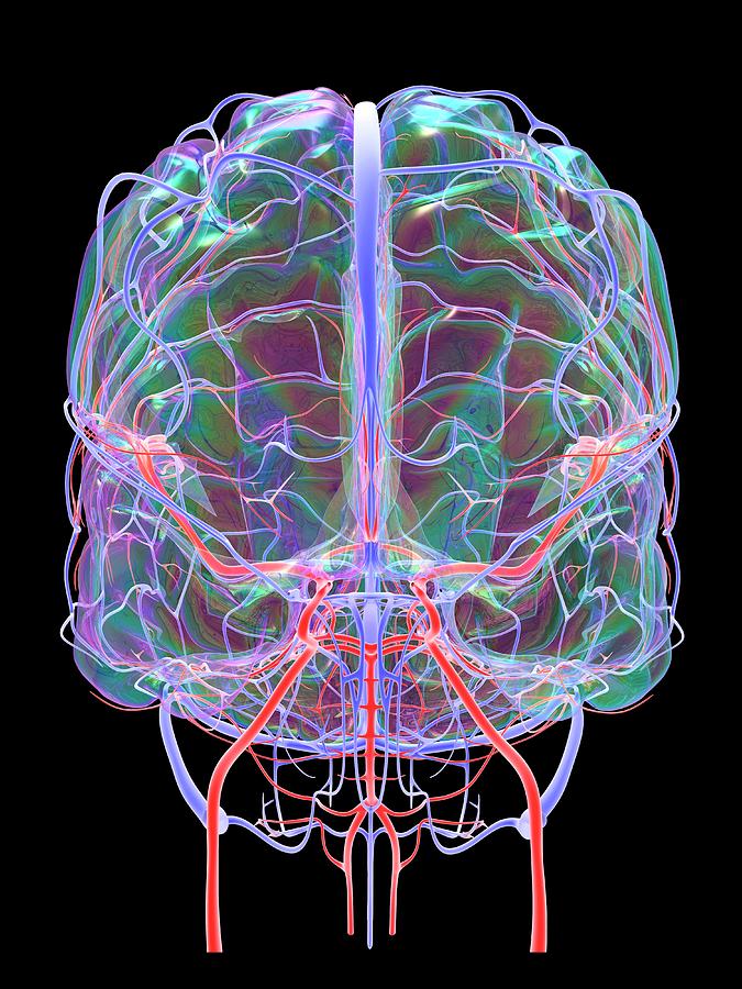 Brain's Blood Supply Photograph by Alfred Pasieka/science Photo Library ...