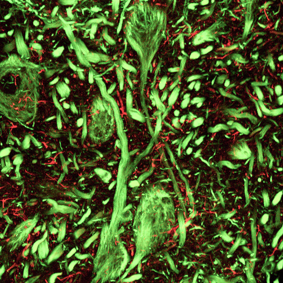 Brainstem Nerve Cells #4 Photograph by C.j.guerin, Phd, Mrc Toxicology Unit/ Science Photo Library