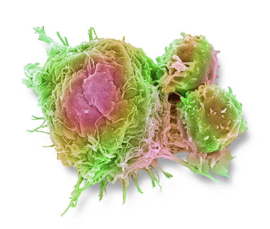 Cancer Cell And T Lymphocytes #4 Photograph by Steve Gschmeissner