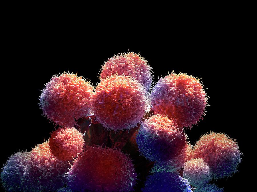 Cancer Cells #4 Photograph by Maurizio De Angelis