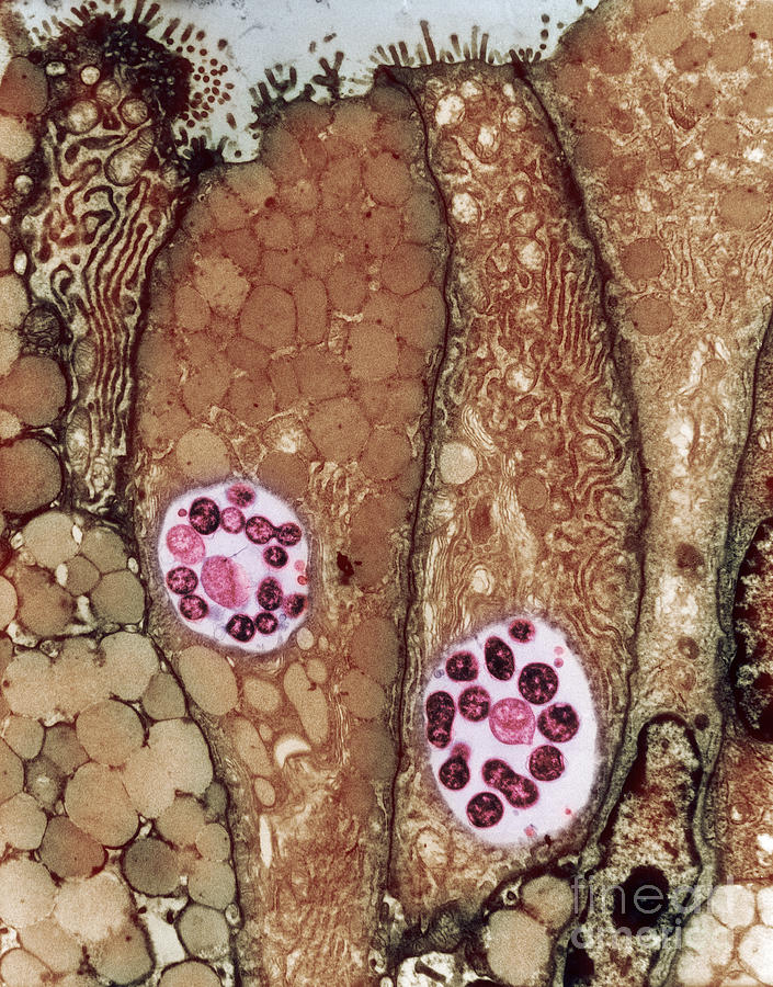 Chlamydia Infection Tem #6 Photograph by David M Phillips
