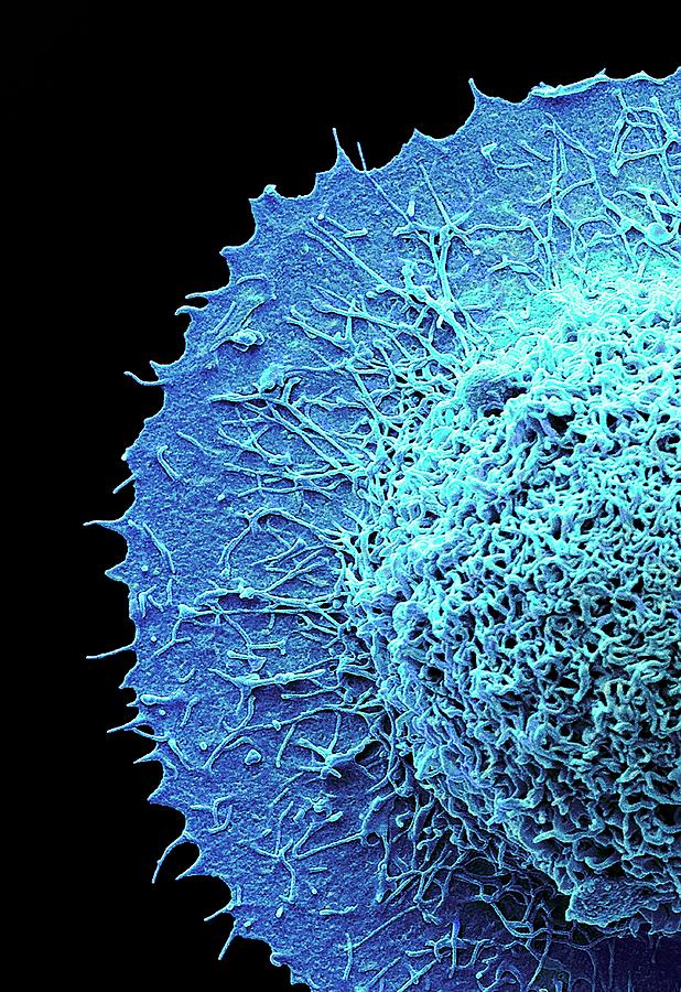 Colorectal Cancer Cell #4 Photograph by Steve Gschmeissner/science Photo Library