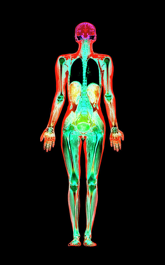 Coloured Mri Scan Of A Whole Human Body (female) #4 Photograph by Simon Fraser/science Photo Library