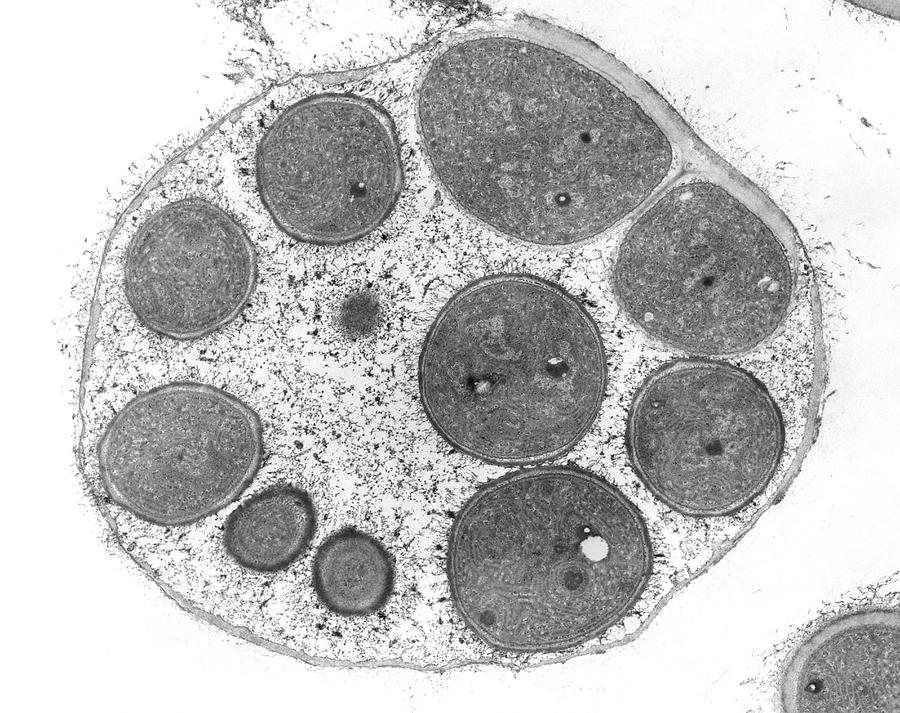 Cyanobacteria Endospores (dermocarpa Sp.) #4 Photograph by Dennis Kunkel Microscopy/science Photo Library
