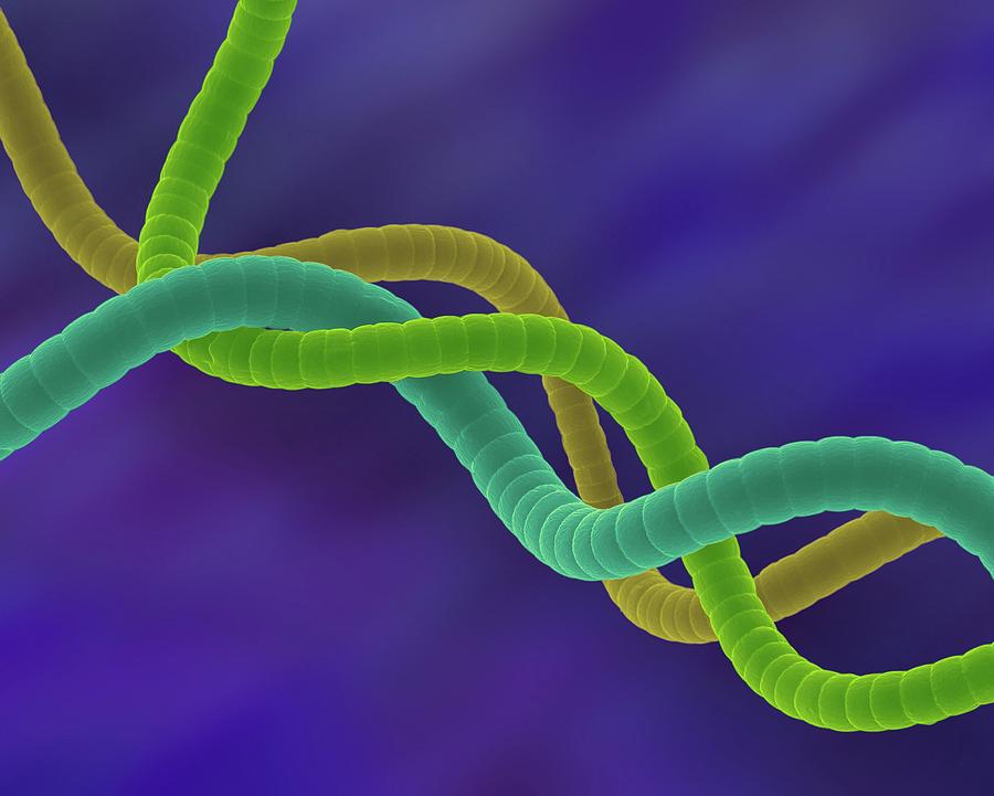 Cyanobacterium (spirulina Platensis) #4 Photograph by Dennis Kunkel Microscopy/science Photo Library