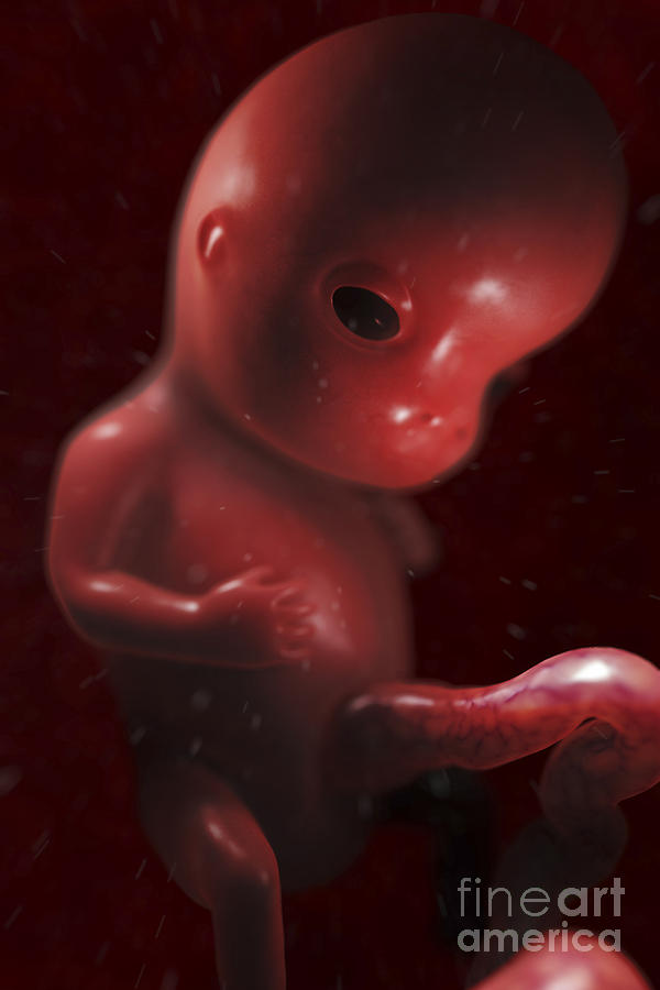 Developing Fetus Week10 #4 Photograph by Science Picture Co