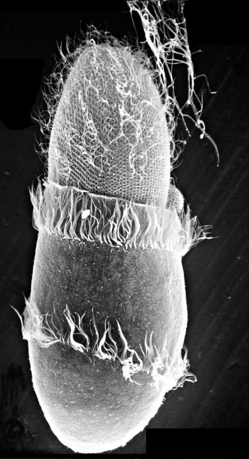 Didinium Attacking Paramecium, Sem #4 Photograph by Greg Antipa