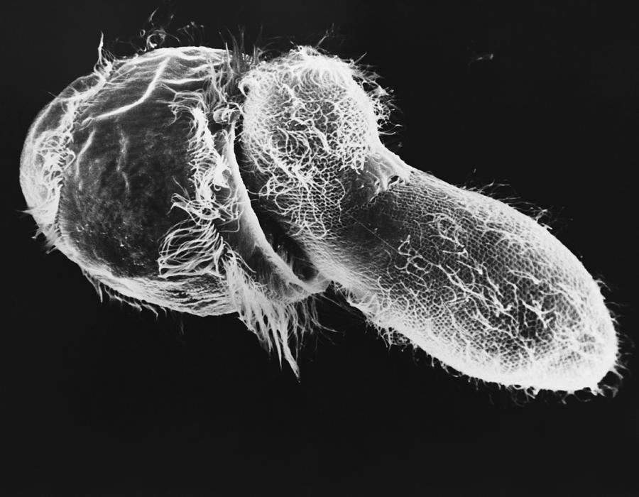 Didinium Ingesting Paramecium Sem Photograph by Greg Antipa - Pixels