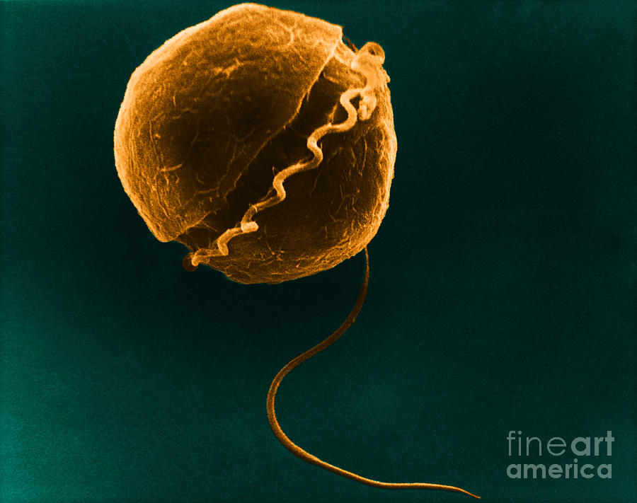 Dinoflagellate, Sem #4 Photograph by David M. Phillips