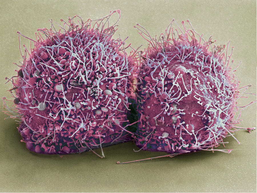 Dividing Hela Cells, Sem Photograph by Science Source
