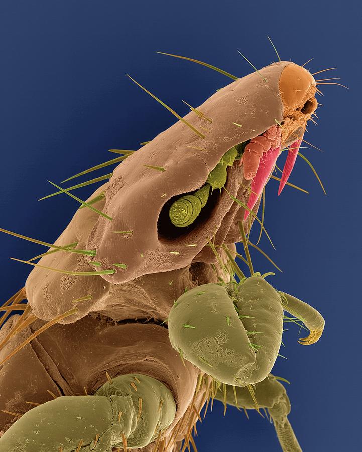 Dog Chewing Louse Photograph by Dennis Kunkel Microscopy/science Photo ...