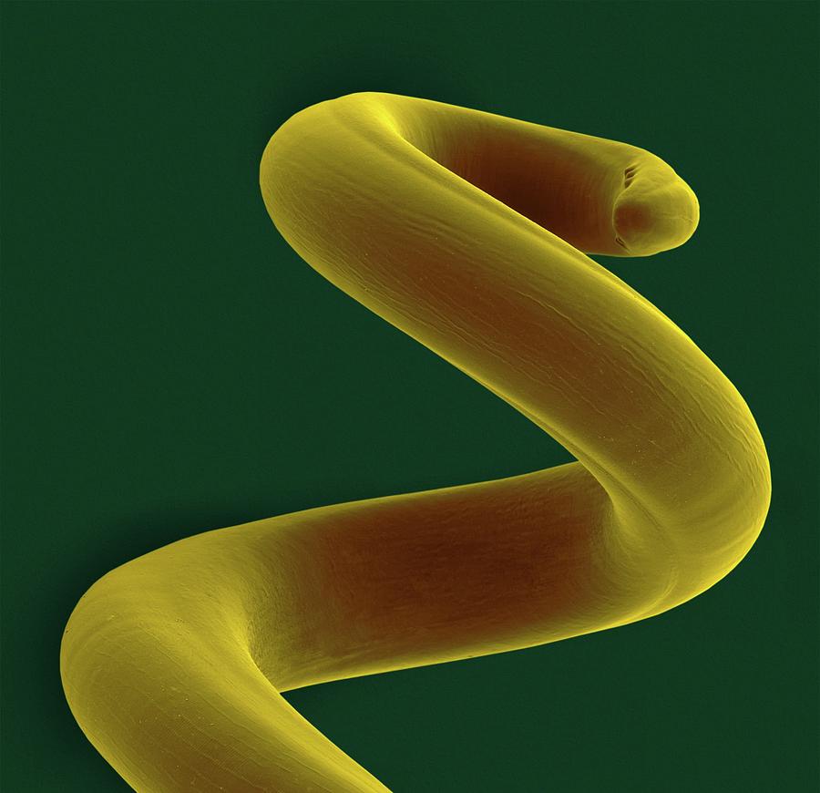 Dog Lungworm Photograph by Dennis Kunkel Microscopy/science Photo Library