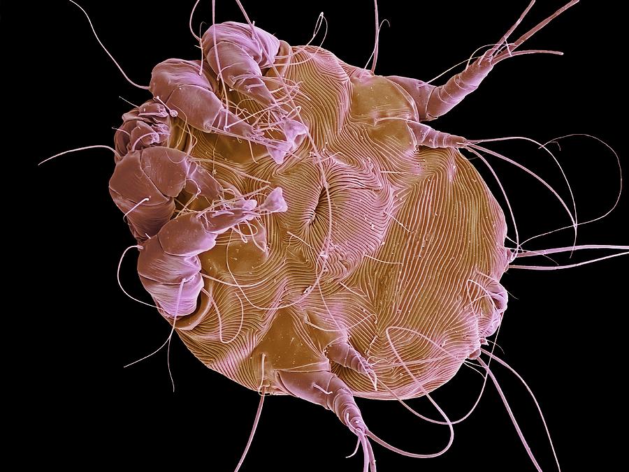 Nature Photograph - Dust Mite. Sem #4 by Steve Gschmeissner