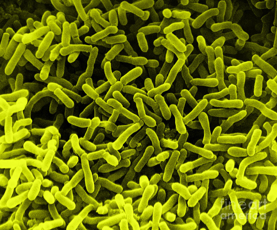 E. Coli Bacteria, Sem #4 Photograph by David M. Phillips