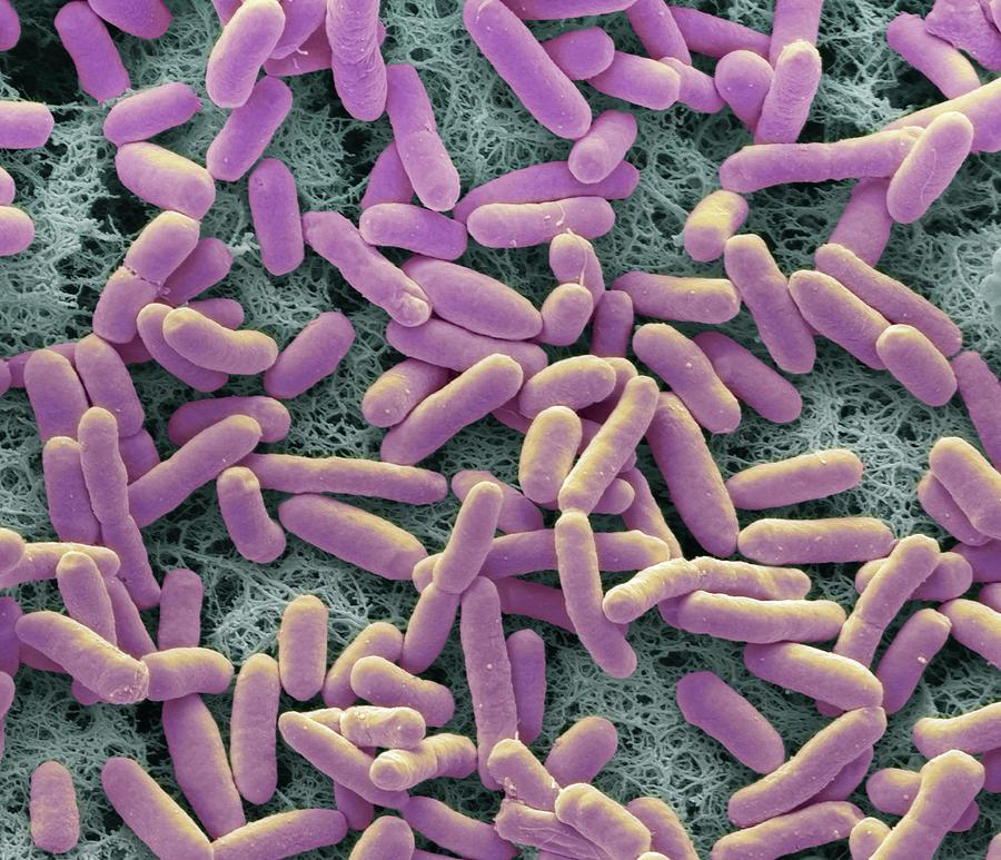 E. Coli Bacteria Photograph by Steve Gschmeissner/science Photo Library ...