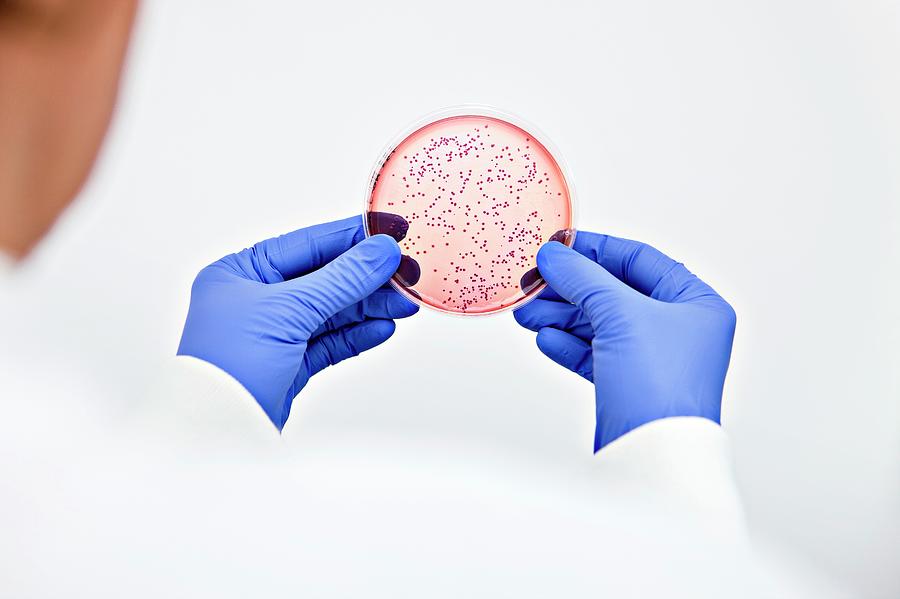 E. Coli Bacterial Culture Photograph by Lewis Houghton/science Photo ...