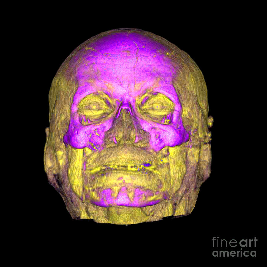 Enhanced 3d Ct Of Face And Skull #4 Photograph by Living Art Enterprises