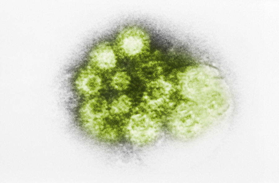 Enterovirus, Tem #4 Photograph by Science Source